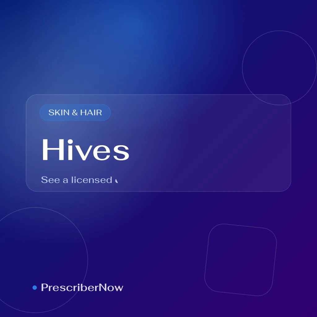 Hives urticaria